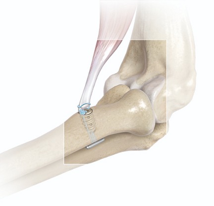 Pathologie