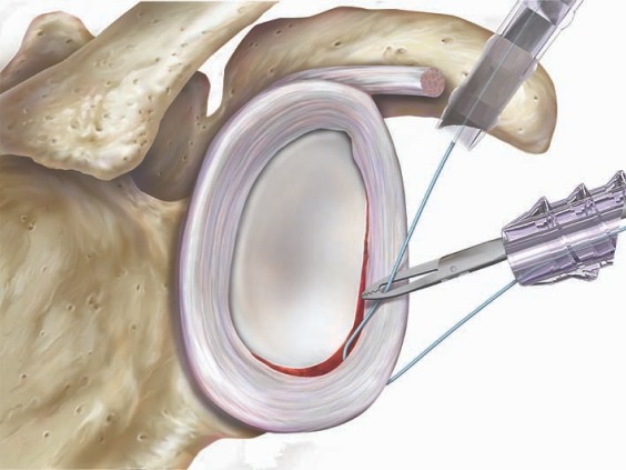 Pathologie